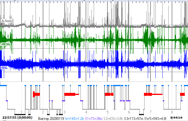 гипнограма.png