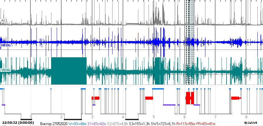 гипнограма_.png