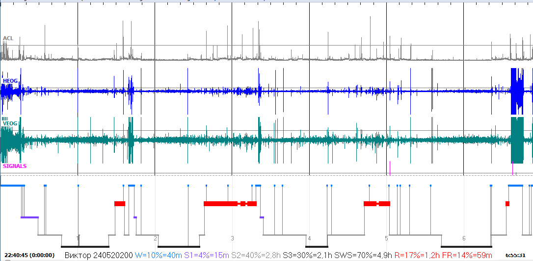 гипнограма_.png
