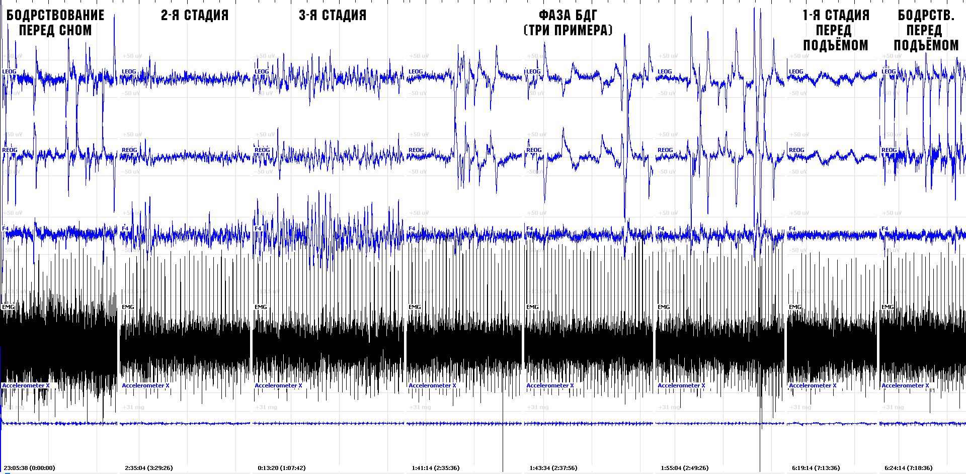 EMG-2.png