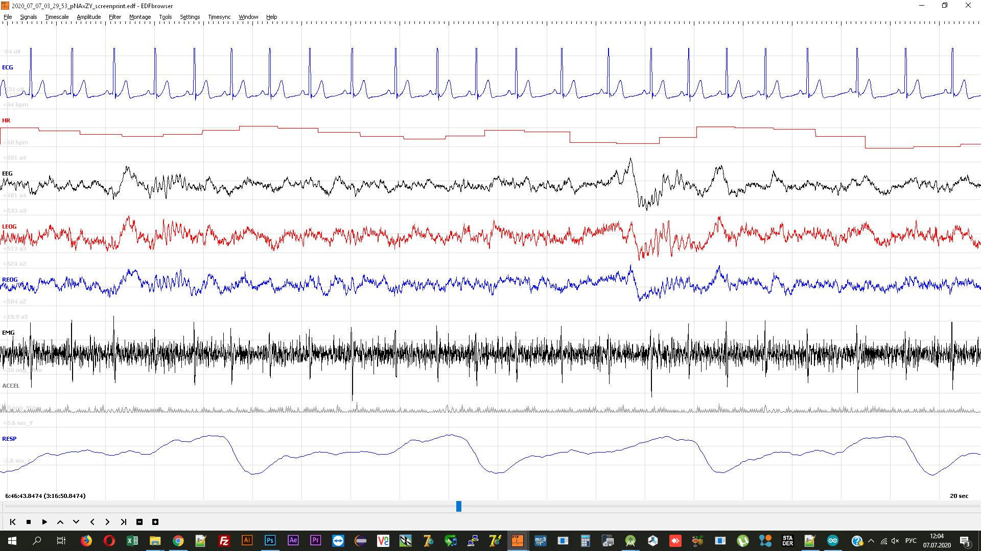 eeg-1.png