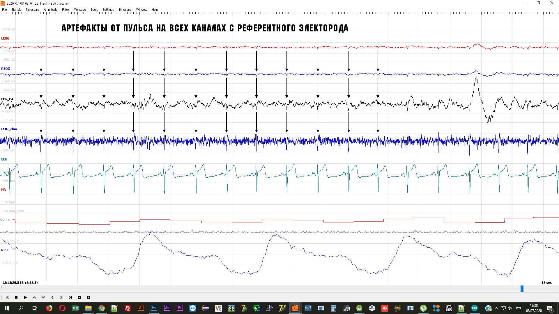 emg-8-7-2020-6.jpg