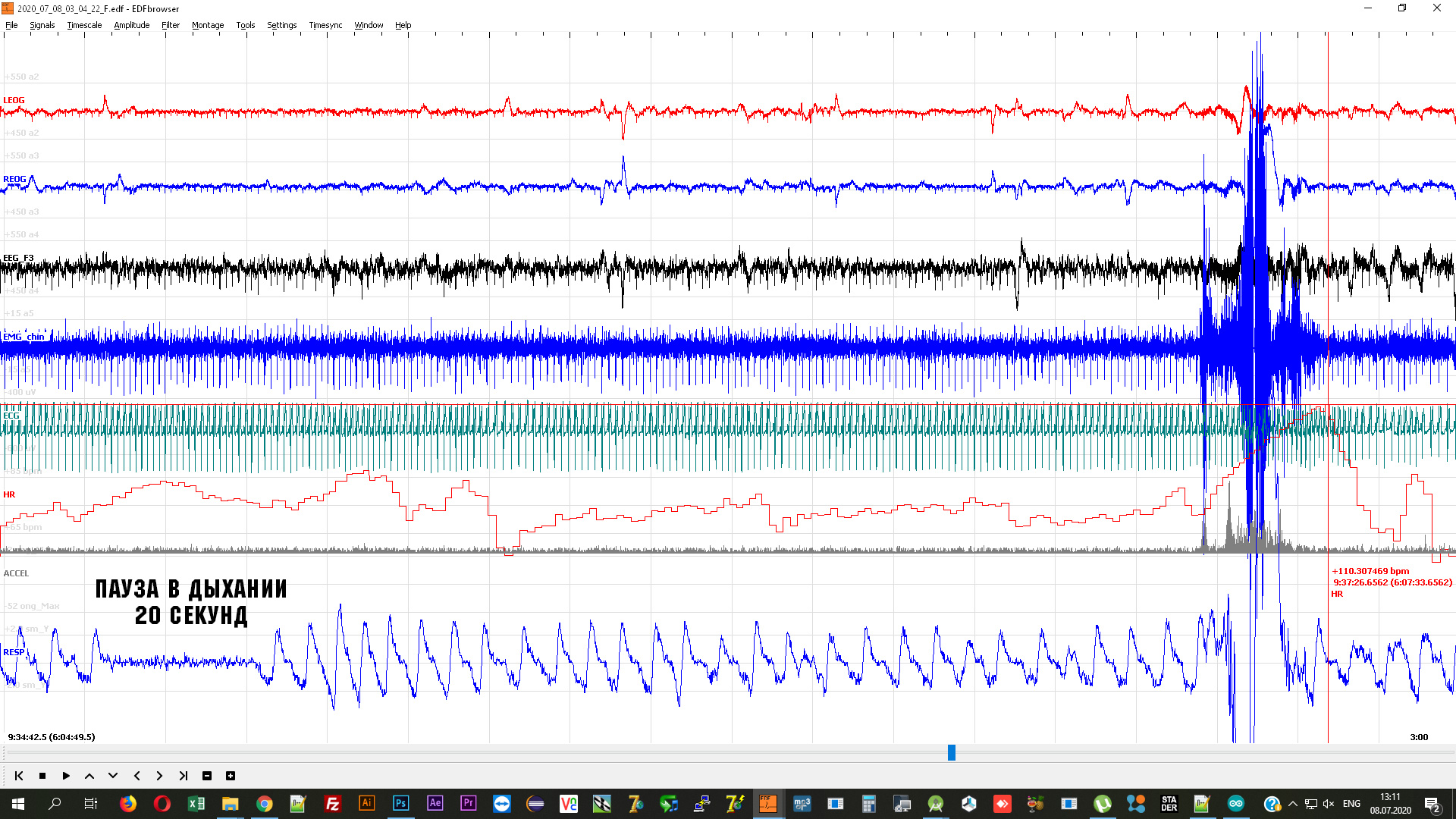 emg-8-7-2020-5.jpg