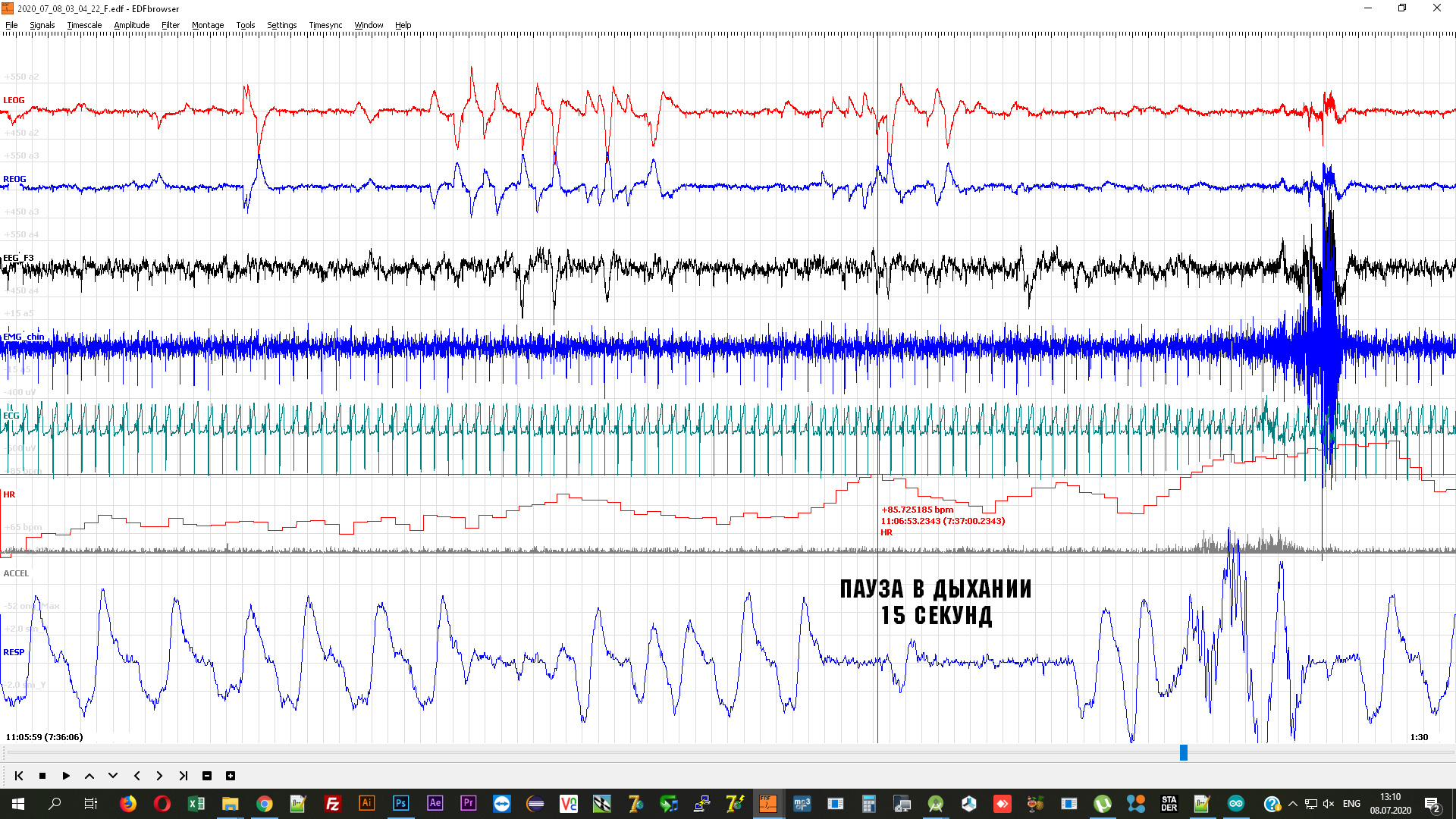 emg-8-7-2020-4.jpg