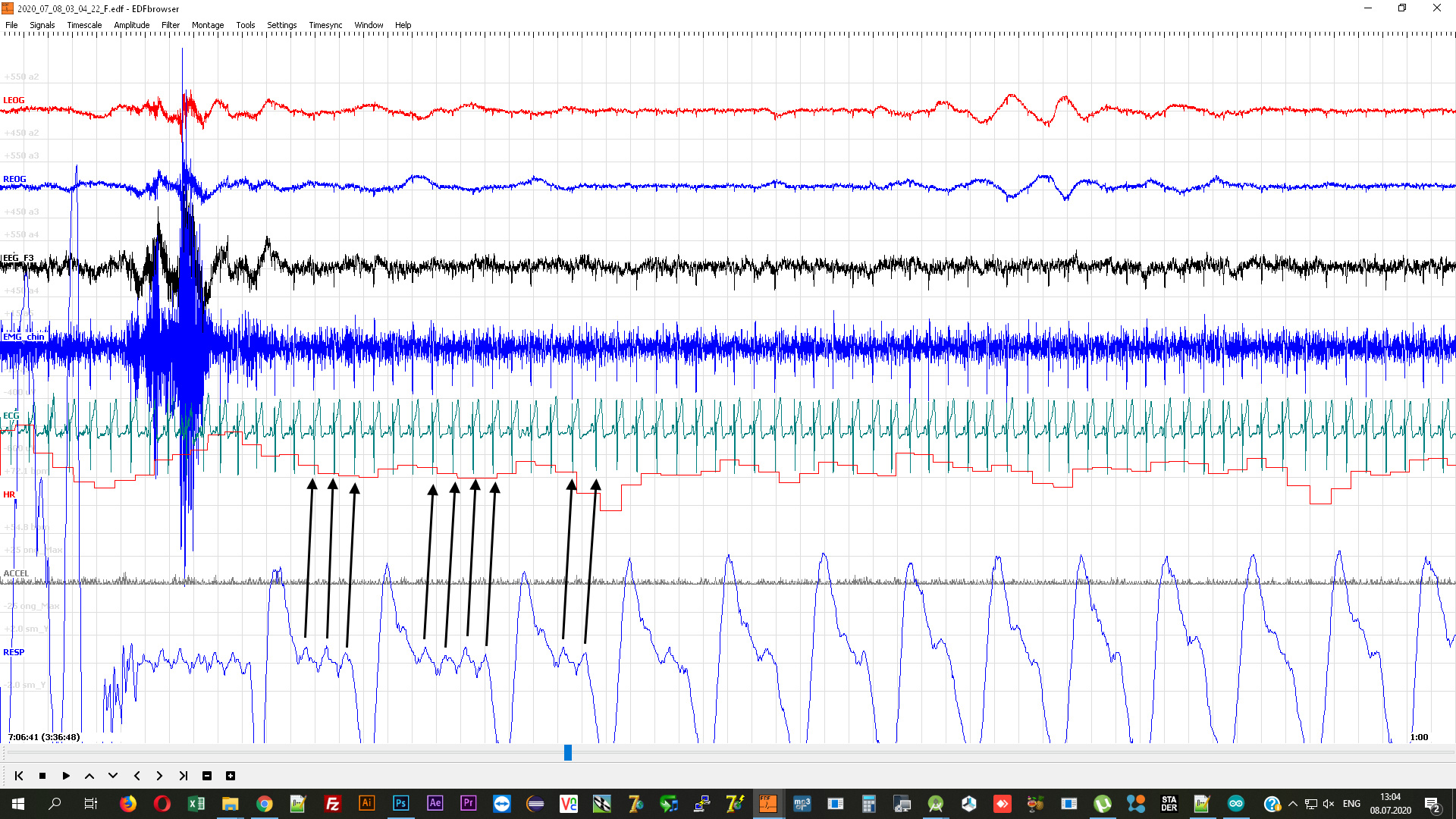 emg-8-7-2020-1.jpg