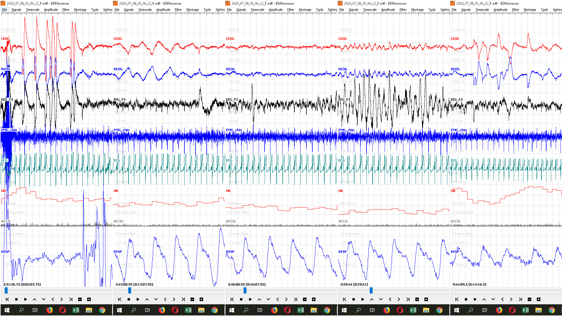 emg-8-7-2020.jpg